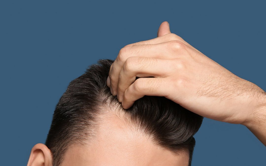 Restoration treatments for men and women with hair loss