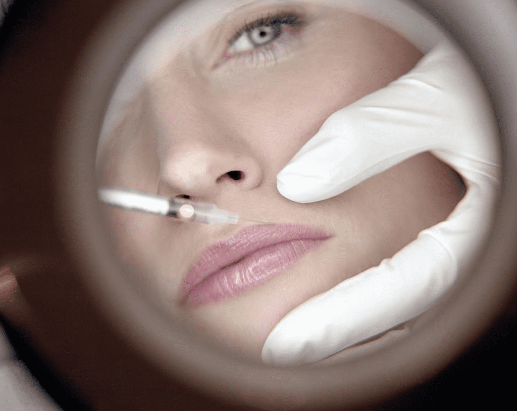 Cosmetic Lips Filler