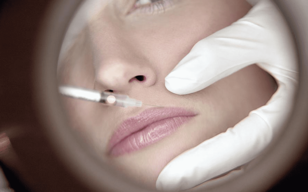 Dermal fillers: Cannula vs. needles