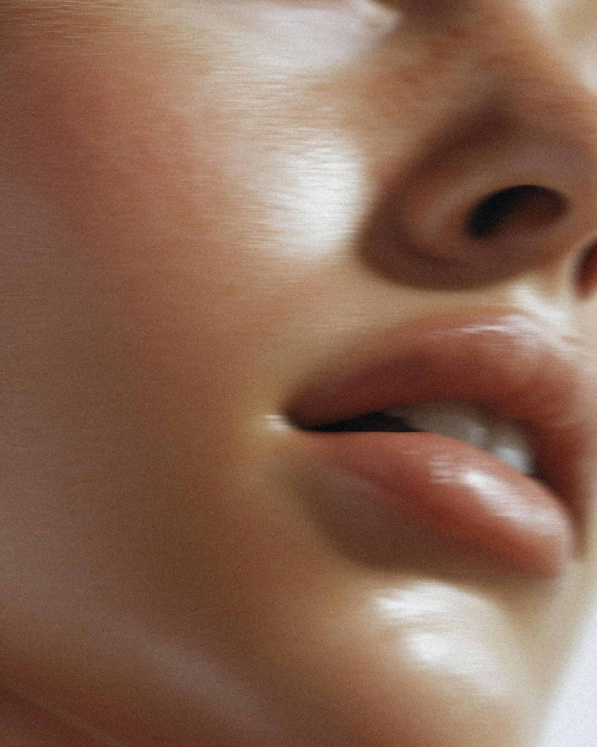 Anti-wrinkle Injections