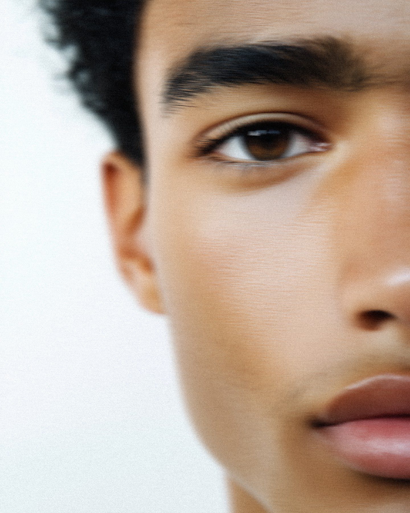 Hair Loss Management 