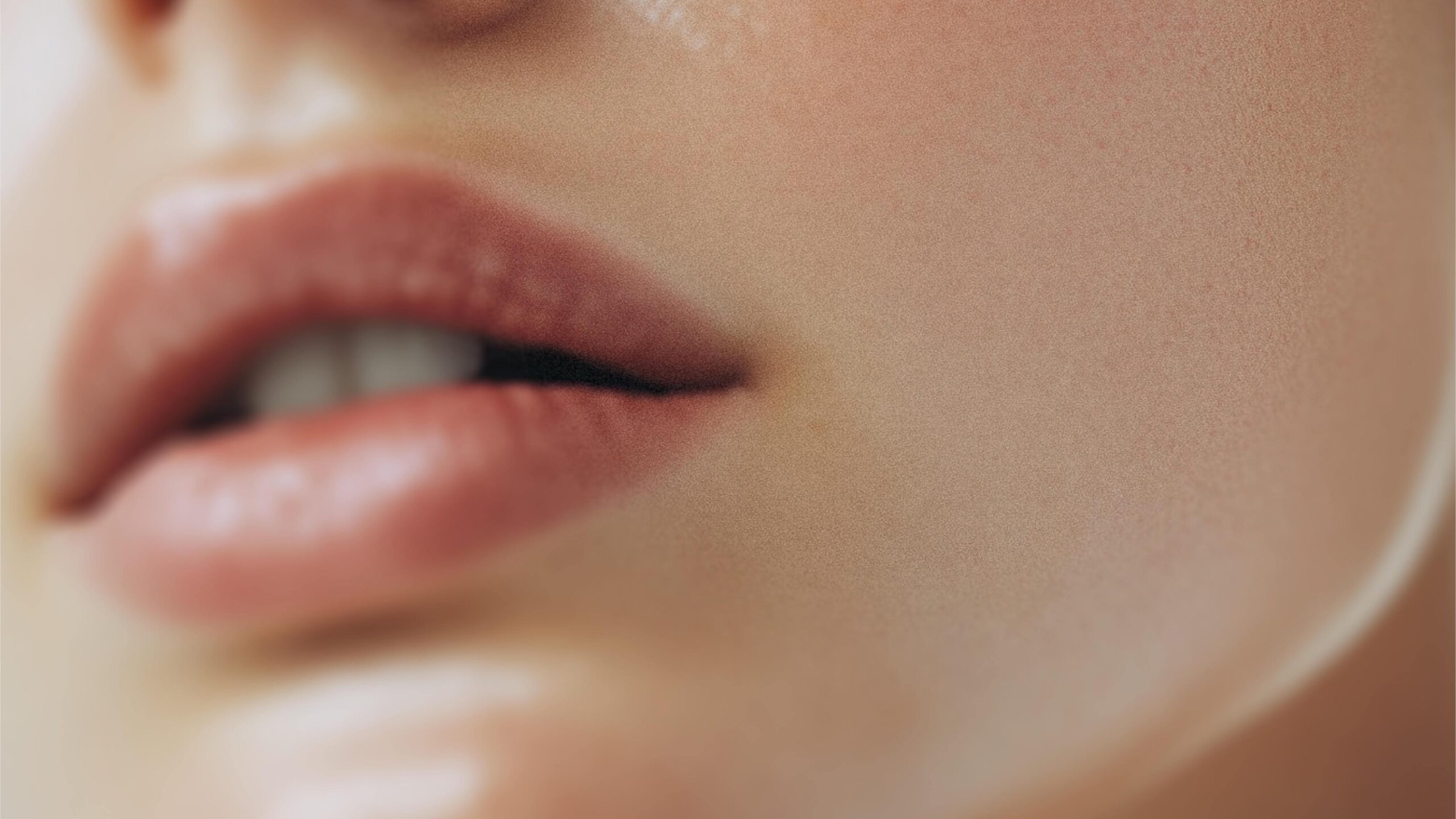 Lip Fillers