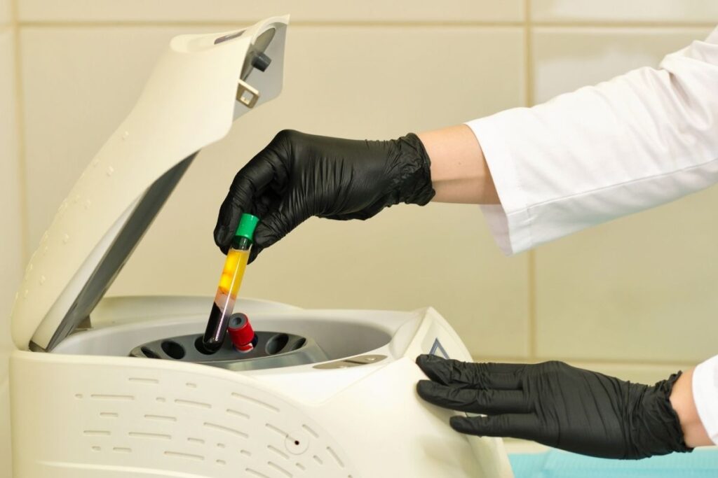 Platelet-Rich Plasma (PRP) injection Procedure, cost, and more! - Dr. Michael
