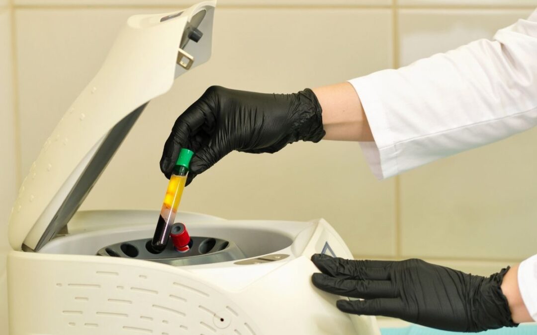 Platelet-Rich Plasma (PRP) injection: Procedure, cost, and more!