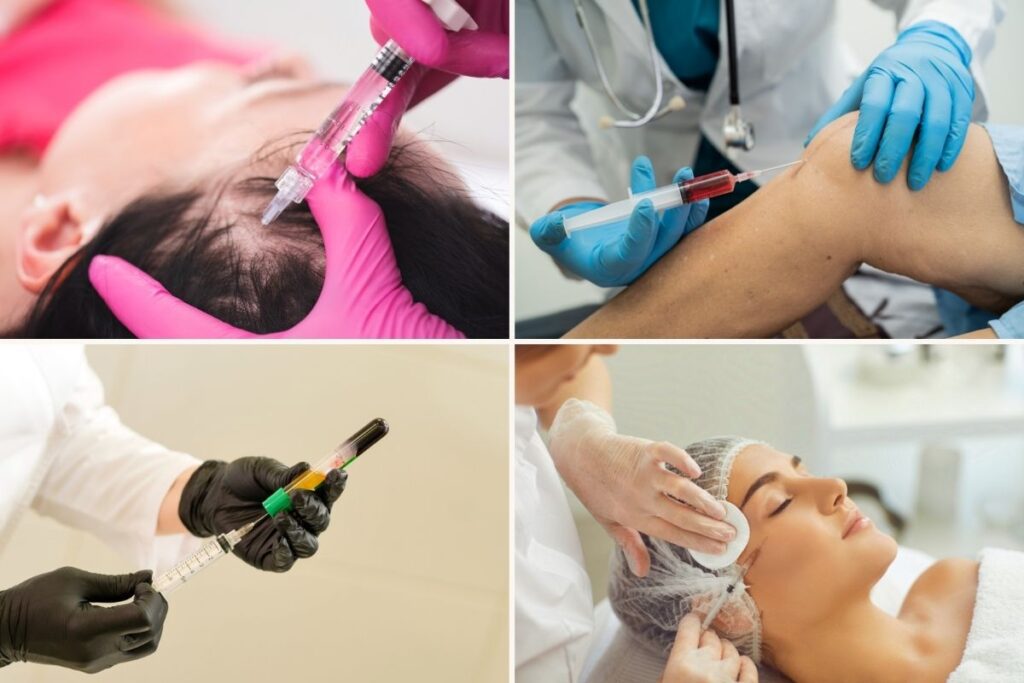 What are platelet-rich plasma injections used for - Dr. Michael