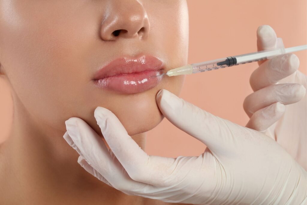 getting lip filler