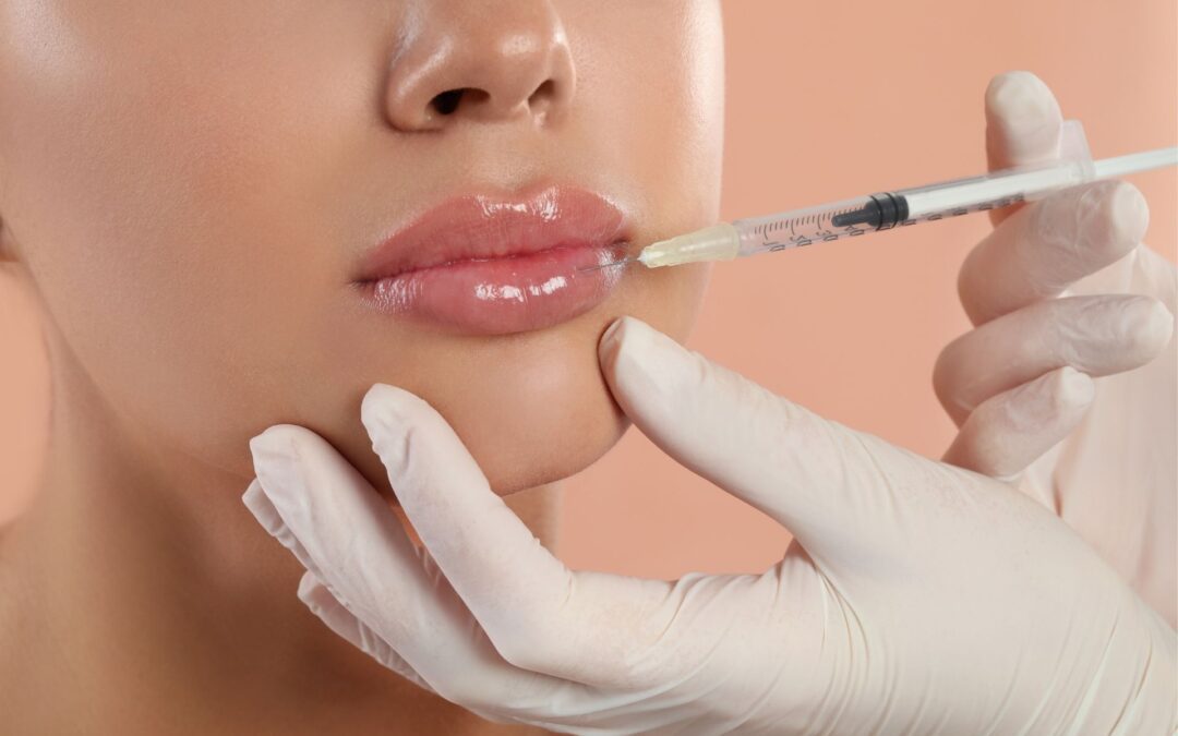 Lip Fillers: What You Can and Can’t Do After Fillers