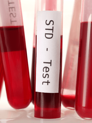 STD Profile Plus