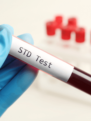 STD Profile