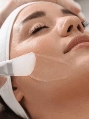 Smartlux LED Light Therapy 4 Skin peels