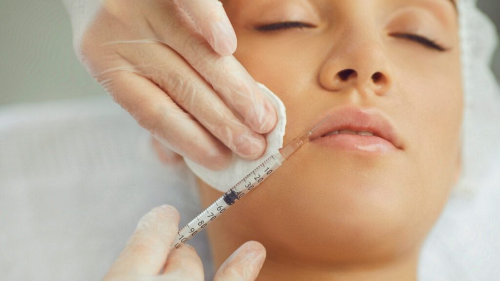 otox filler marionette lines