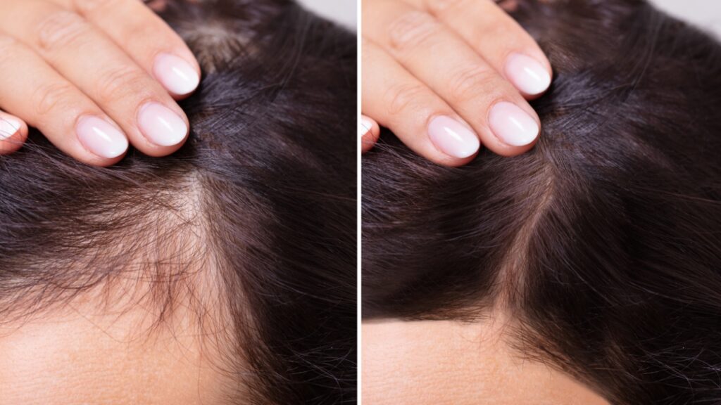 promotes natural hair regrowth