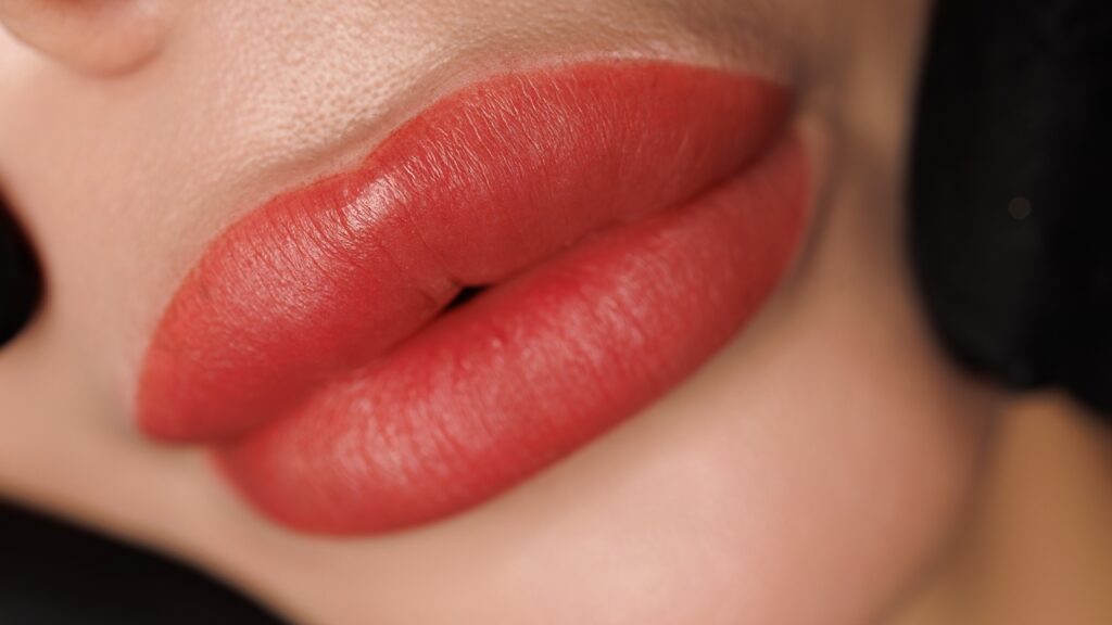 swelling after lip fillers