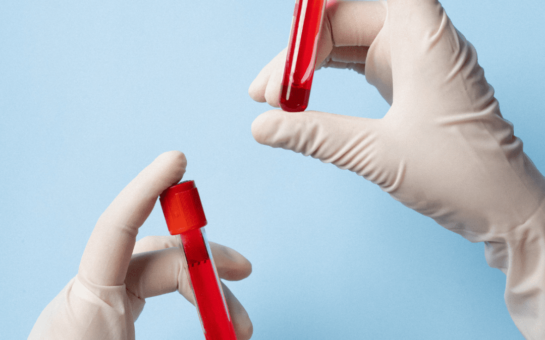 Can a Blood Test Detect Cancer? What Patients Need to Know About Multi-Cancer Detection