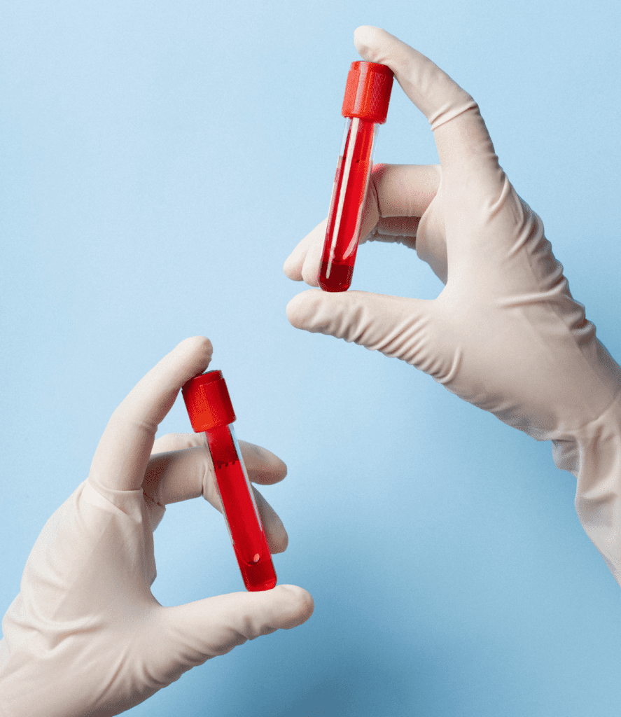 Can a Blood Test Detect Cancer? What Patients Need to Know About Multi-Cancer Detection 6 use blood test to detect cancer