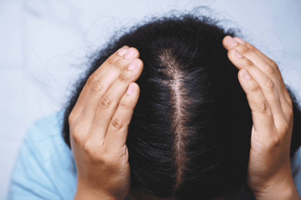 Hair Loss Solutions