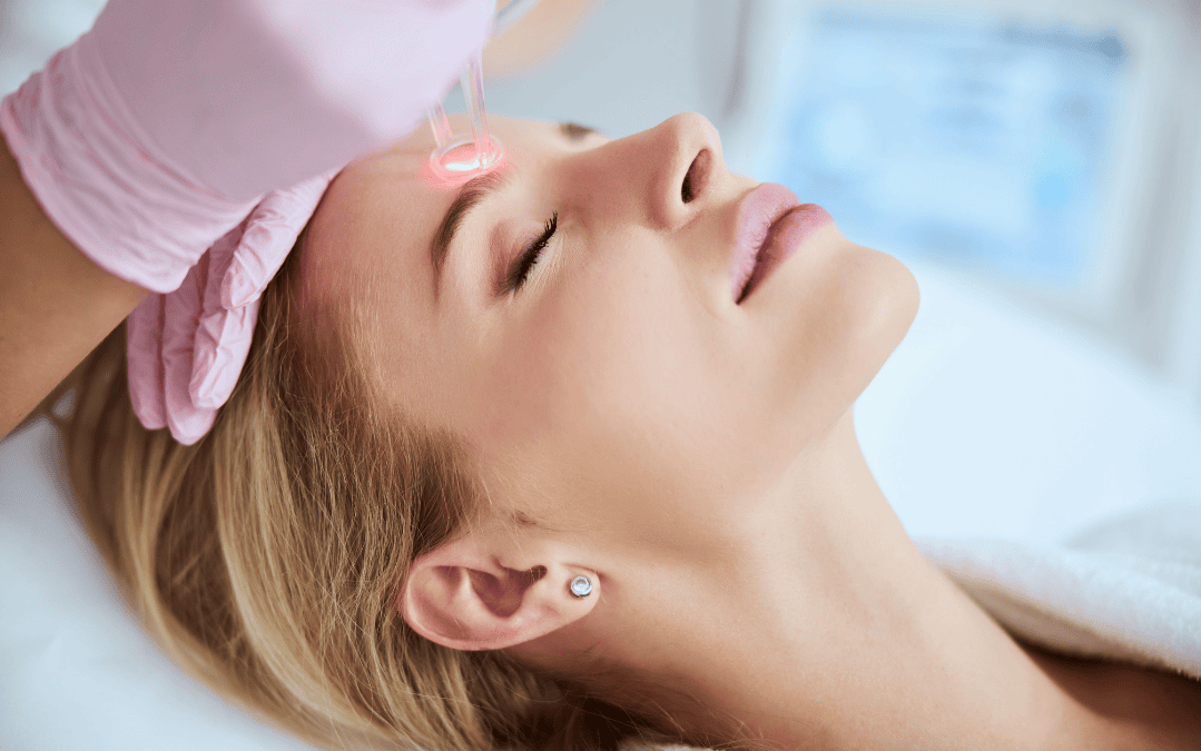 London Venus Viva Skin Resurfacing: What to Know Before Your First Treatment