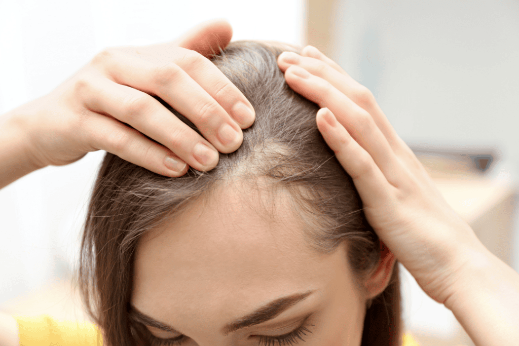 Hair Loss Solutions in London: Therapies, Costs & Realistic Results 4 hair loss solution