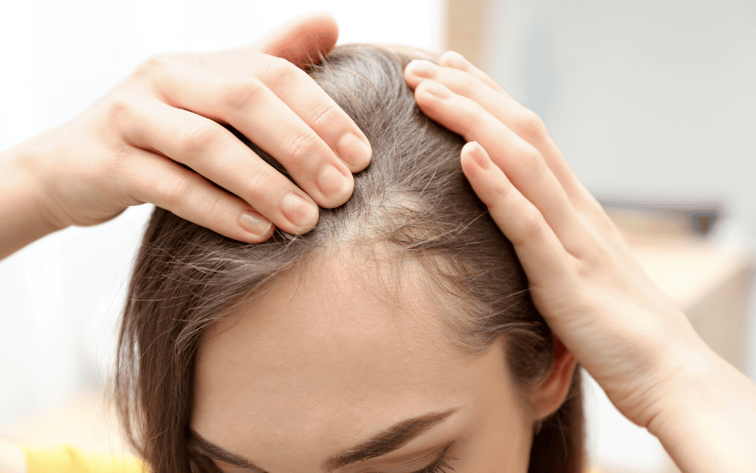 Hair Loss Solutions in London: Therapies, Costs & Realistic Results