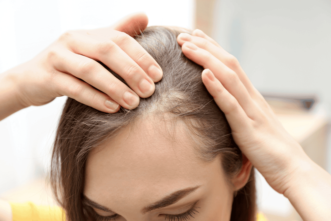 hair loss solution
